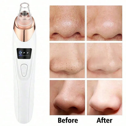 Electric Blackhead Remover Vacuum