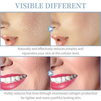 4-in-1 Handheld High Frequency Facial Wand