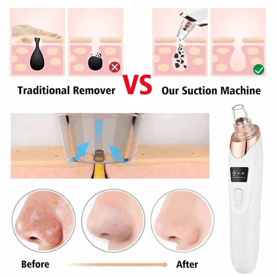 Electric Blackhead Remover Vacuum
