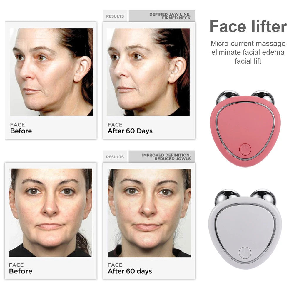EMS Microcurrent Face Lifting Roller